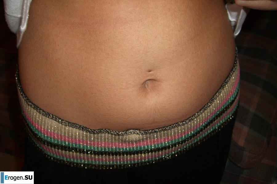 Bailey. Part 13. Photo 11