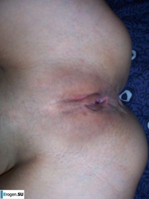 Baba berry again. Part 10. Thumb 16