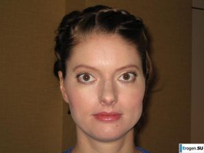 Terrible on the face, kind inside. Part 2. Thumb 40