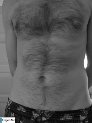 Red and bald. Family album. Thumb 34