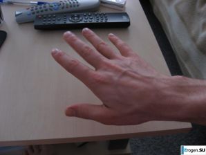 Red and bald. Family album. Part 2. Thumb 12