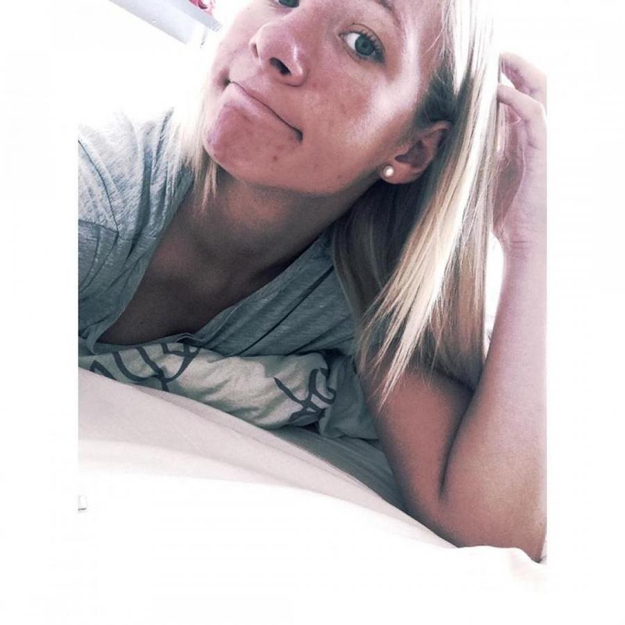 Прыщавое селфи. Фото 11