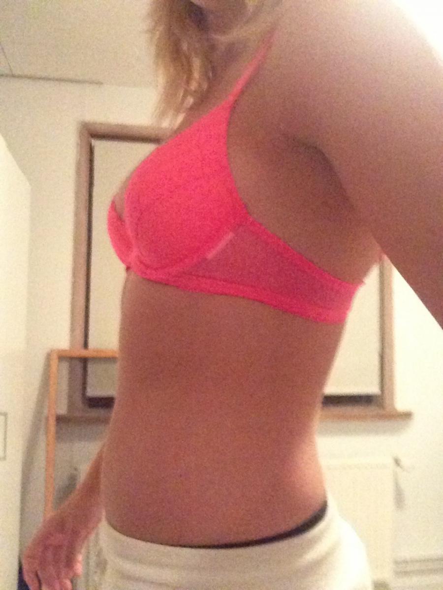 Прыщавое селфи. Фото 14