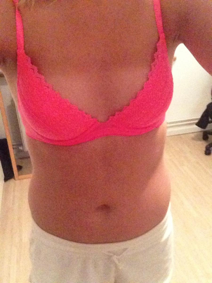 Прыщавое селфи. Фото 30