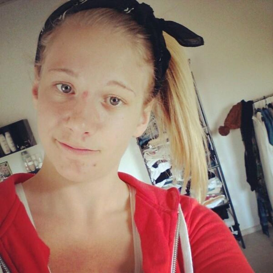 Прыщавое селфи. Фото 6