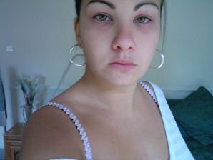 Pierced green-eye. Part 3. Thumb 20