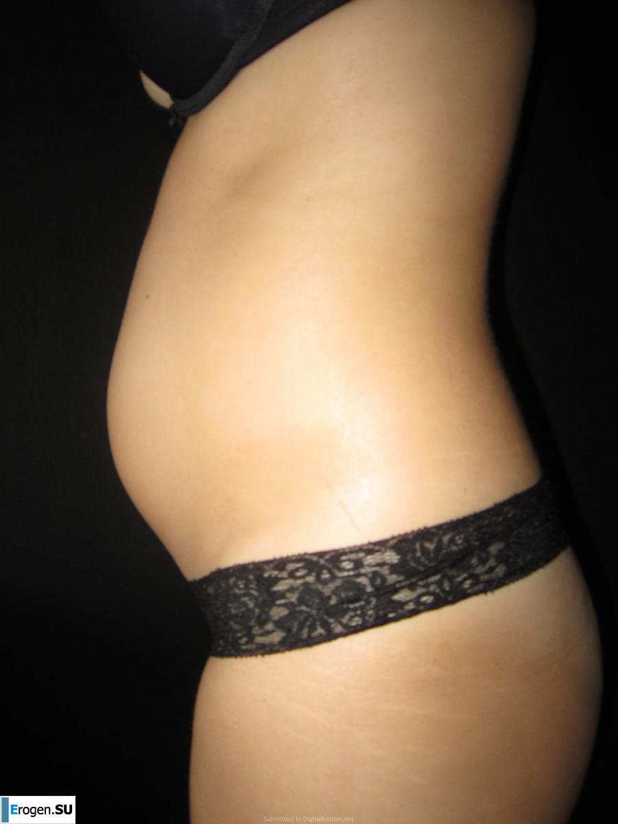 naked pregnant girl. Photo 24