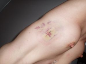 Lesbian on vacation with a friend. Thumb 13